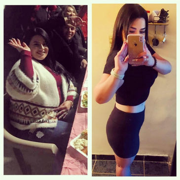 Slider image (7) Dr. Francisco Ortega - Bariatric Surgery